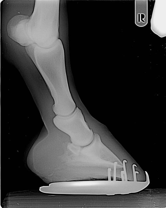 Gebrochene Zehenachse
