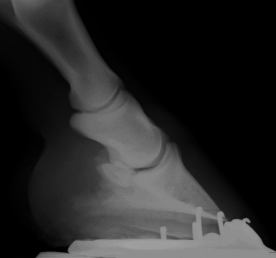 Seitliches Rntgenbild