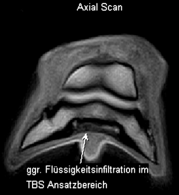 Kernspintomografie