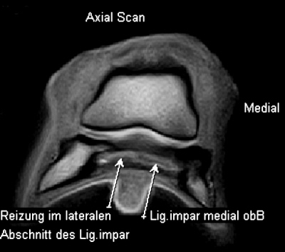 Kernspintomografie