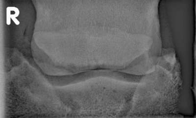 Oxspring Rntgenaufnahme