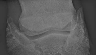 Oxspring Rntgenaufnahme