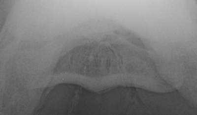 Skyline Rntgenaufnahme