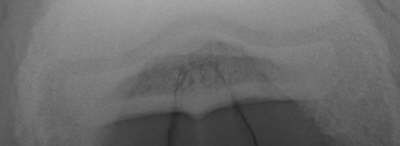 Skyline Rntgenaufnahme